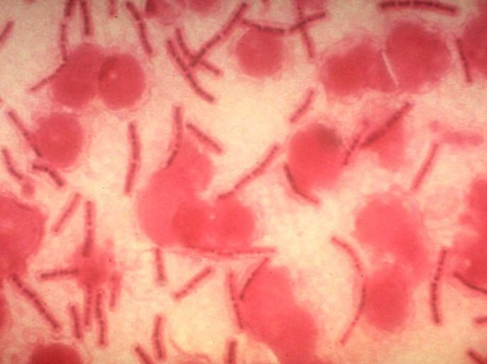 395395 01: A microscopic view of stained anthrax bacteria in an undated photo from the Command at Fort Detrick, Md. A Florida man has been hospitalized with inhalation anthrax. Authorities have discounted terrorism as the cause of the bacterial infection in Florida. (Photo Courtesy of U.S. Army Medical Research and Development/Getty Images)