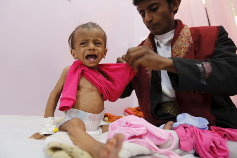 bloga- مجاعة اليمن