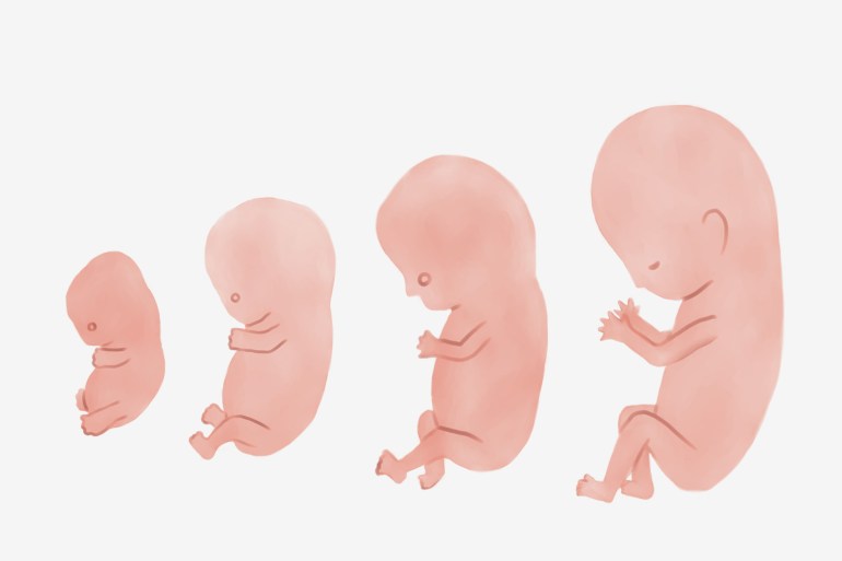 Stages of human fetal development; 3 months pregnant نمو الجنين خلال الأشهر الثلاثة الأولى من الحمل