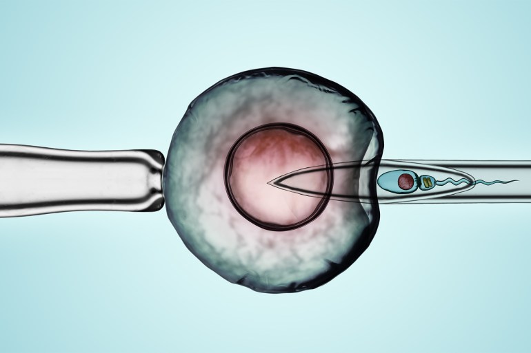Artificial Insemination by Intracytoplasmic Sperm Injection shutterstock_705834757