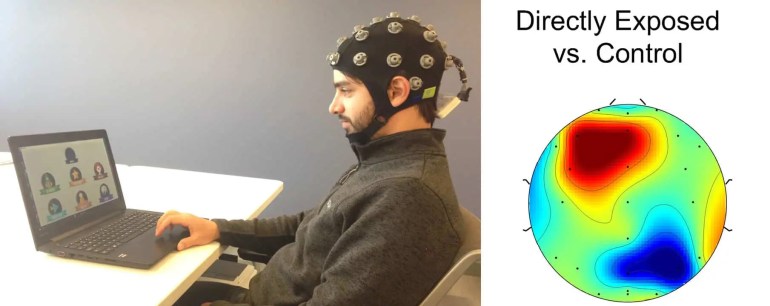 ** للاستخدام الداخلي ** صورة3: استخدم الباحثون غطاء لاسلكي للرأس يعمل على تسجيل تخطيط كهربية الدماغ (بلوس كلايمت)