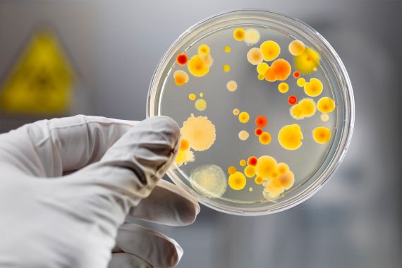 Gloved Hand Holding Petri Dish with Bacteria Culture - stock photo