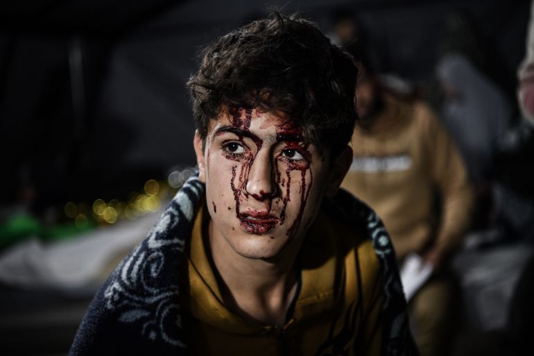 RAFAH, GAZA - FEBRUARY 12: (EDITORS NOTE: Image depicts graphic content) Injured Palestinians, including children are brought to Kuwait Hospital for treatment following Israeli attacks on Rafah City in the south of Gaza on February 12, 2024. ( Abed Zagout - Anadolu Agency )